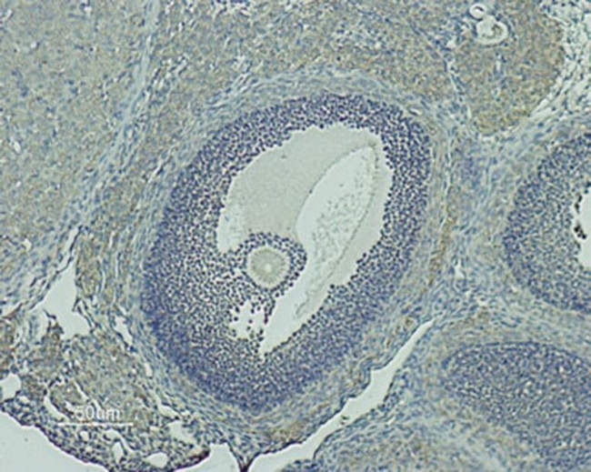 GnRHR (extracellular) Antibody in Immunohistochemistry (Paraffin) (IHC (P))