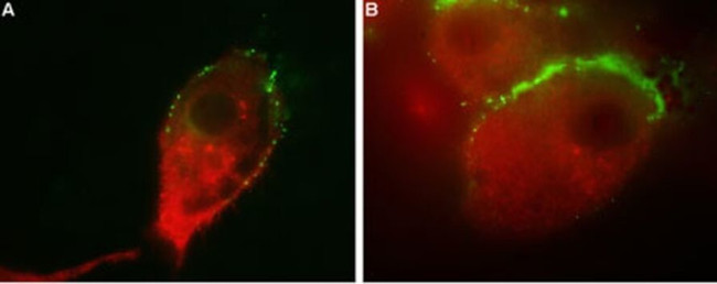 VGAT Antibody in Immunocytochemistry (ICC/IF)
