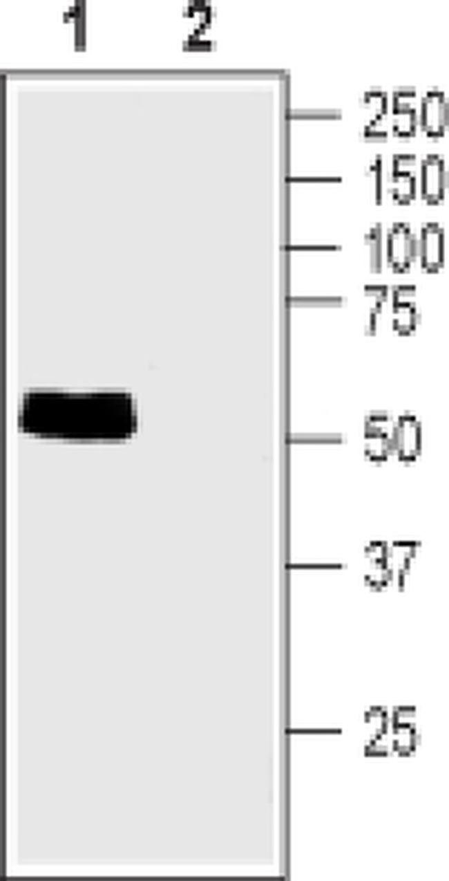 TAUT Antibody in Western Blot (WB)