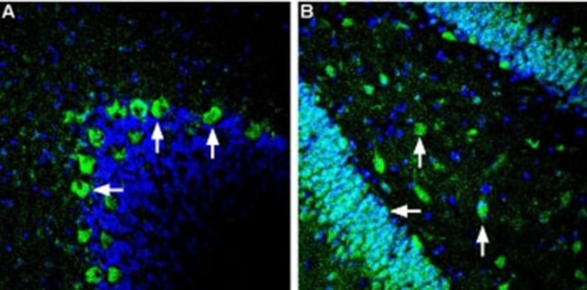 GLUT2 Antibody in Immunohistochemistry (Frozen) (IHC (F))