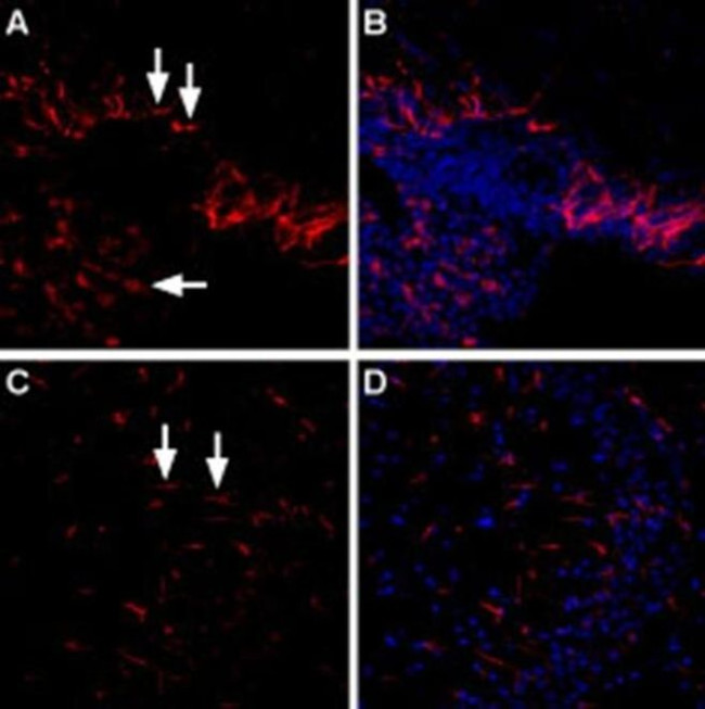 LPAR4 (extracellular) Antibody in Immunohistochemistry (IHC)