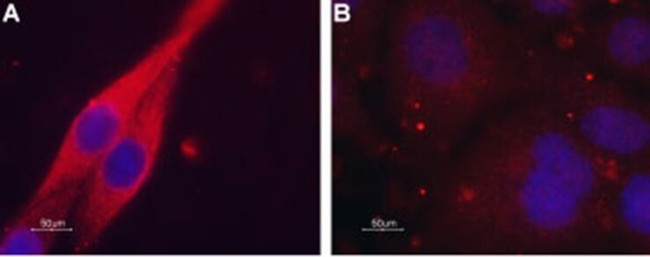 CHRM4 Antibody in Immunocytochemistry (ICC/IF)
