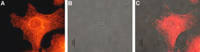 MC1R Antibody in Immunocytochemistry (ICC/IF)