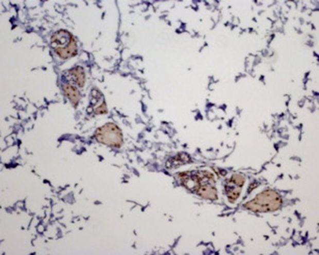 MC5R Antibody in Immunohistochemistry (Paraffin) (IHC (P))