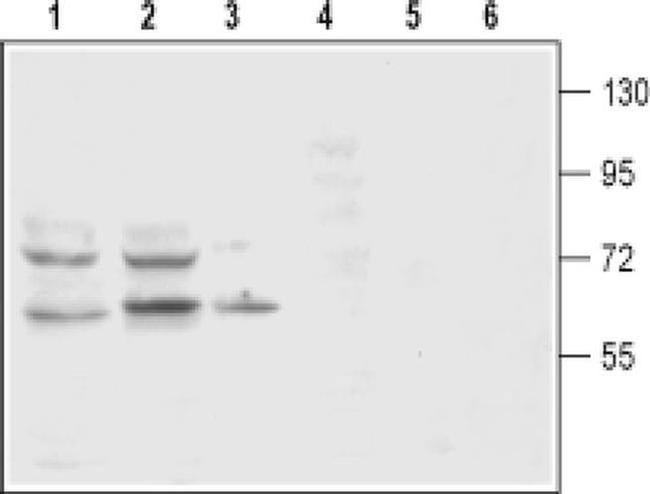 Dopamine Transporter (extracellular) Antibody in Western Blot (WB)