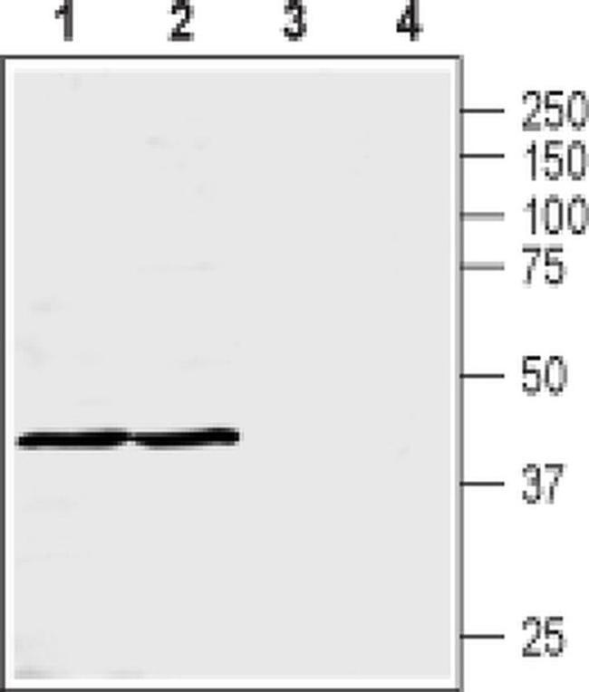 SLC16A8 Antibody in Western Blot (WB)