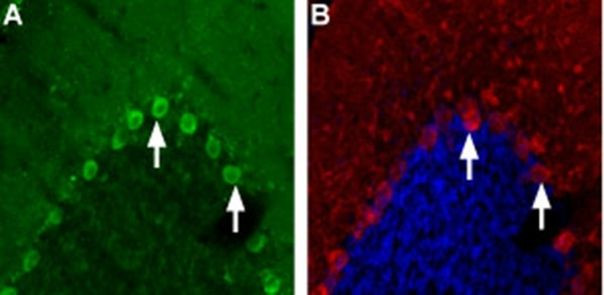 CHRNA4 (extracellular) Antibody in Immunohistochemistry (Frozen) (IHC (F))