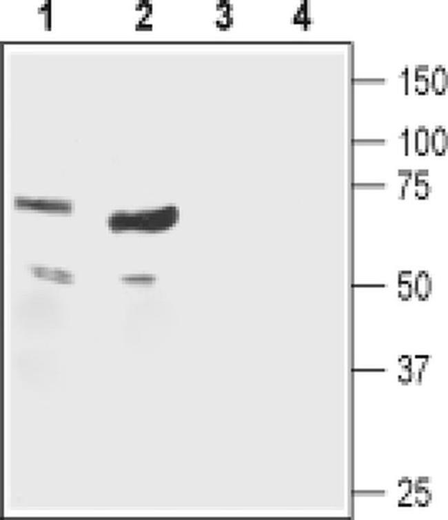 CHRNB1 (extracellular) Antibody in Western Blot (WB)