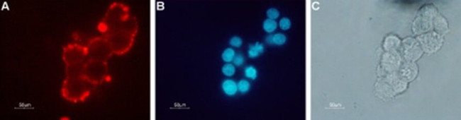 CHRNB2 (extracellular) Antibody in Immunocytochemistry (ICC/IF)