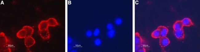 CHRNB4 (extracellular) Antibody in Immunocytochemistry (ICC/IF)