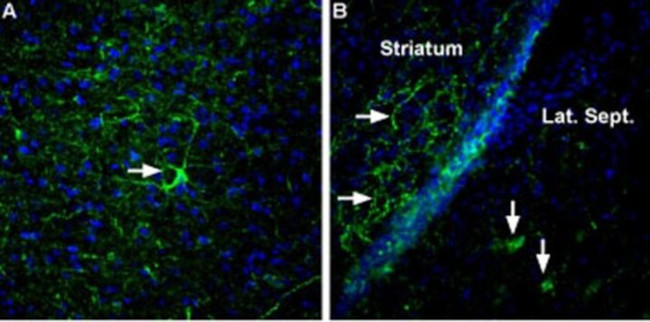 NRXN3 (extracellular) Antibody in Immunohistochemistry (IHC)