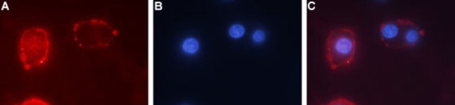 TrkC (extracellular) Antibody in Immunocytochemistry (ICC/IF)