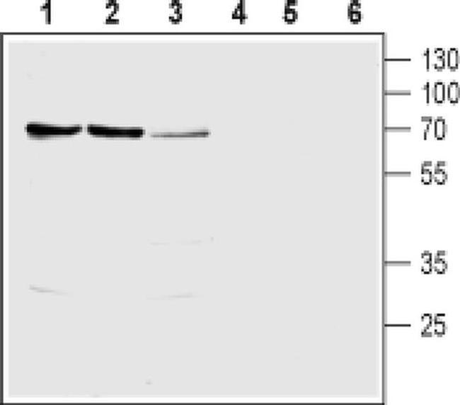 SLC28A1 Antibody in Western Blot (WB)