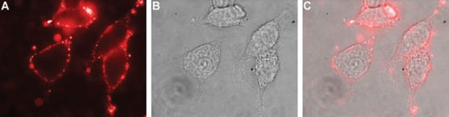 SLC4A4 (extracellular) Antibody in Immunocytochemistry (ICC/IF)