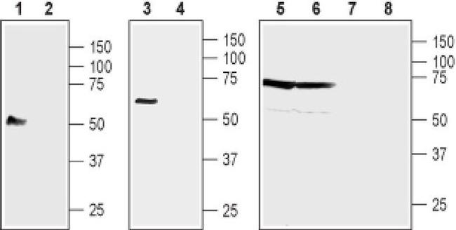 NIPA4 (extracellular) Antibody in Western Blot (WB)
