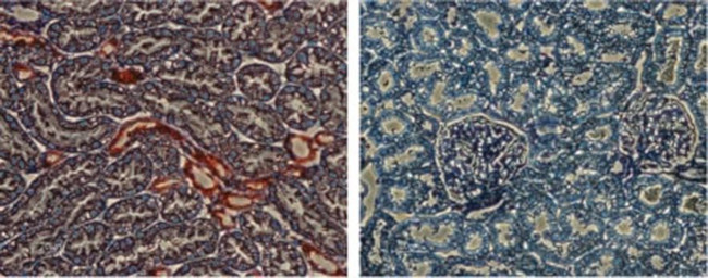 Kir1.1 (KCNJ1) Antibody in Immunohistochemistry (IHC)