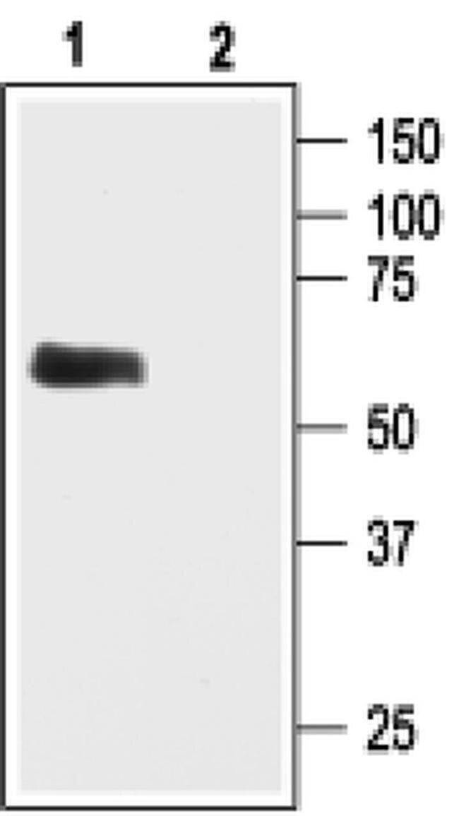 Kir3.1 (KCNJ3) Antibody in Western Blot (WB)