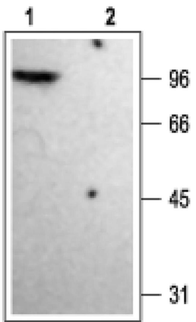 KV1.4 (KCNA4) Antibody in Western Blot (WB)