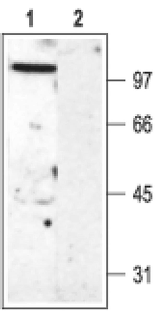KV3.2 (KCNC2) Antibody in Western Blot (WB)
