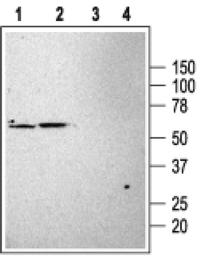 KCNK3 Antibody in Western Blot (WB)