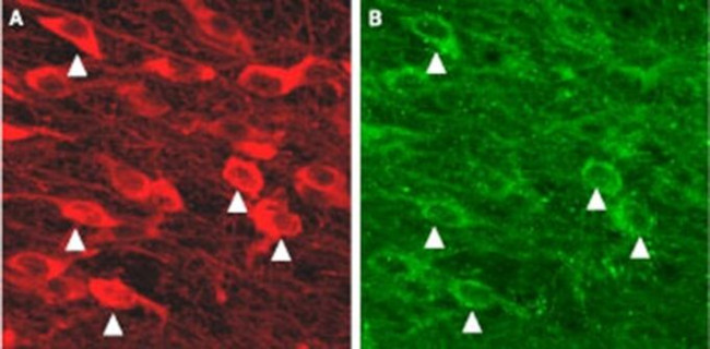 KCNN3 Antibody in Immunohistochemistry (IHC)
