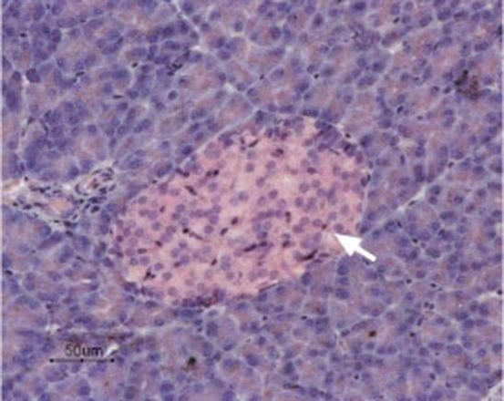 KCNK5 Antibody in Immunohistochemistry (IHC)