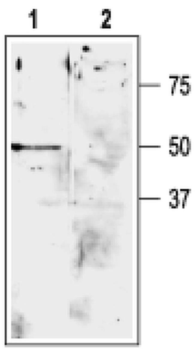 KCNK9 (extracellular) Antibody in Western Blot (WB)