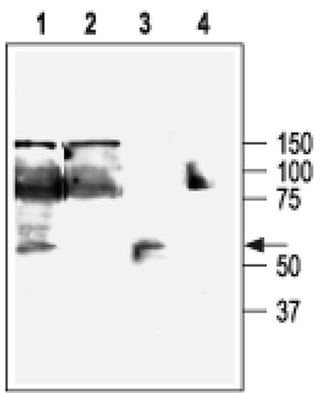 KCNN4 Antibody in Western Blot (WB)