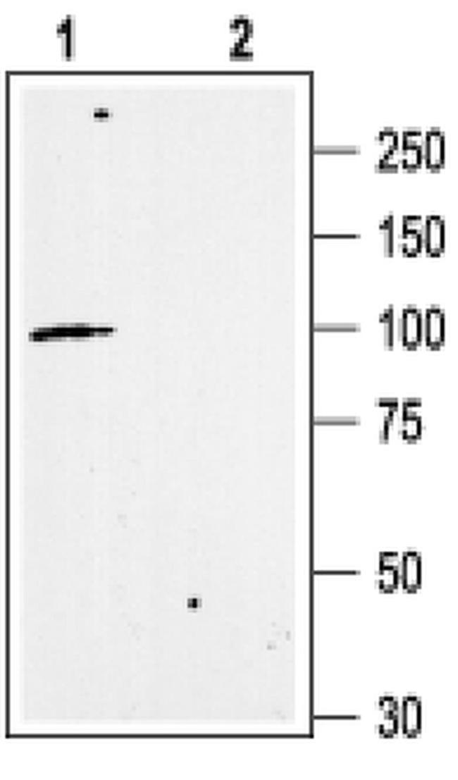 KCNN3 Antibody in Western Blot (WB)