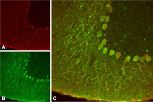 KCNK4 Antibody in Immunohistochemistry (IHC)