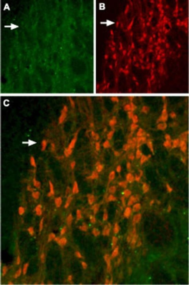 KCNH6 Antibody in Immunohistochemistry (IHC)