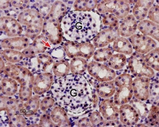KCNK13 (extracellular) Antibody in Immunohistochemistry (Paraffin) (IHC (P))
