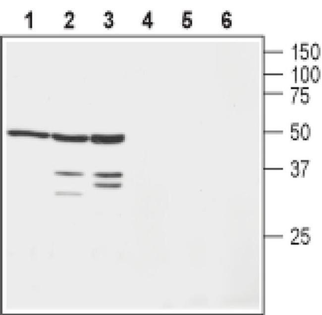 KVbeta1 (KCNAB1) Antibody in Western Blot (WB)