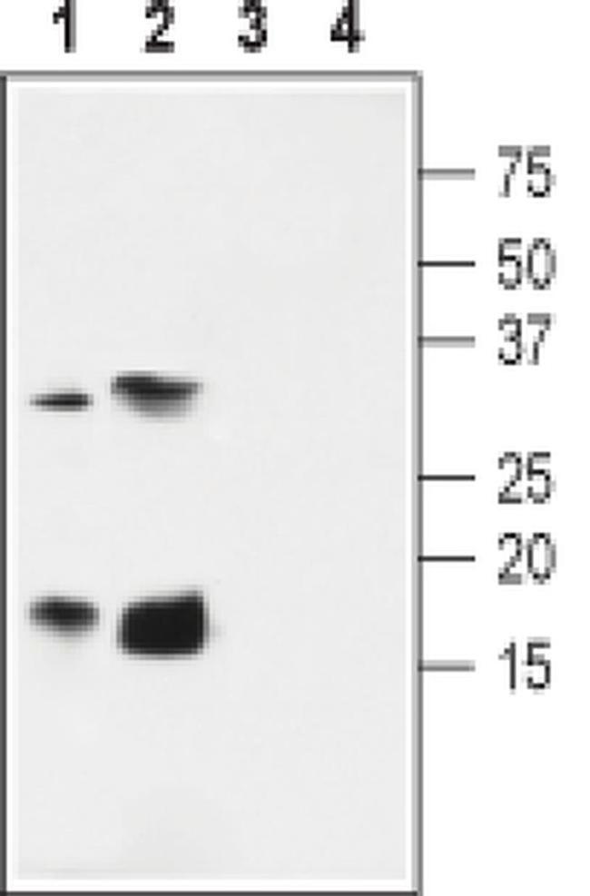 KCNE4 Antibody in Western Blot (WB)