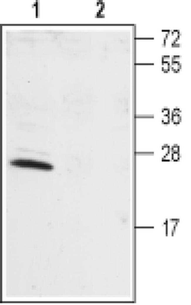 KCNIP1 Antibody in Western Blot (WB)