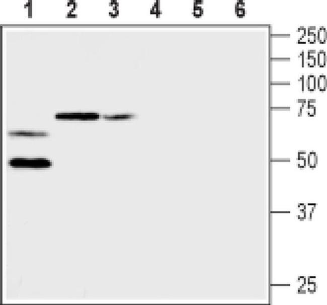 KV1.2 (KCNA2) (extracellular) Antibody in Western Blot (WB)