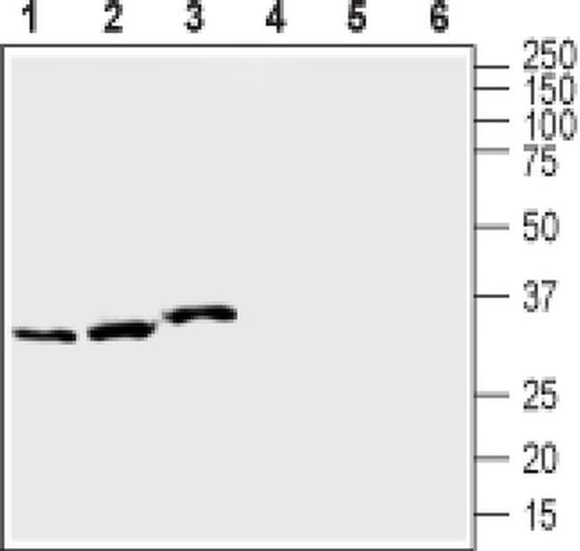 KCNE1 Antibody in Western Blot (WB)