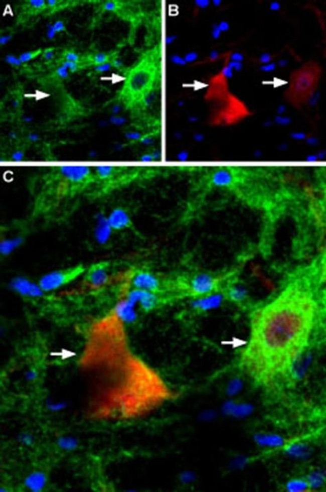 P2X4 Antibody in Immunohistochemistry (IHC)