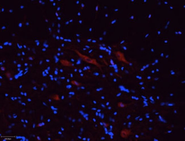 P2X5 Antibody in Immunohistochemistry (Frozen) (IHC (F))