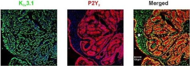 P2Y2 Antibody in Immunohistochemistry (IHC)