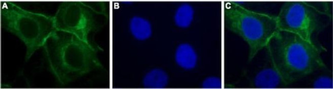 P2Y11 Antibody in Immunocytochemistry (ICC/IF)
