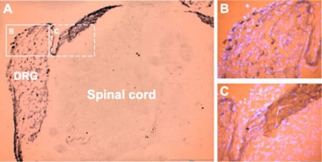P2X3 Antibody in Immunohistochemistry (IHC)