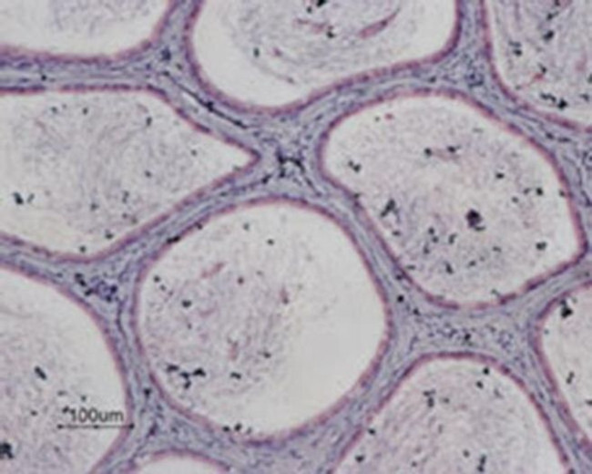 P2Y13 Antibody in Immunohistochemistry (Paraffin) (IHC (P))