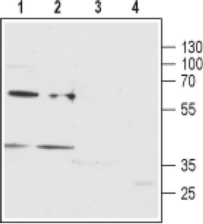 P2Y12 (extracellular) Antibody in Western Blot (WB)