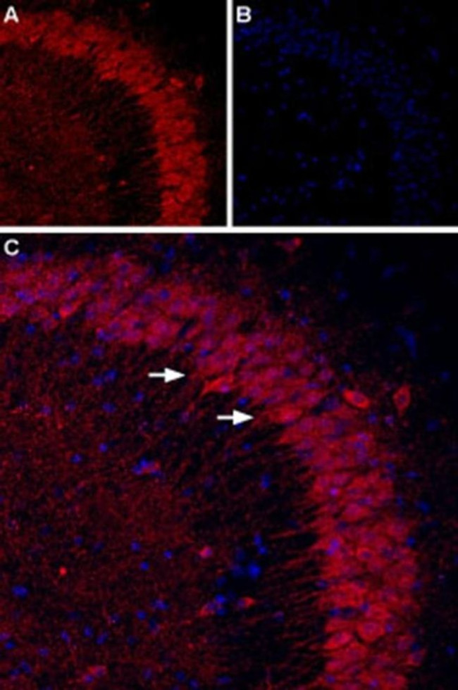 P2Y1 (extracellular) Antibody in Immunohistochemistry (IHC)