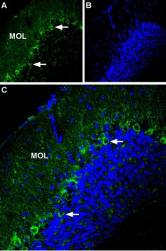 P2X1 (extracellular) Antibody in Immunohistochemistry (IHC)