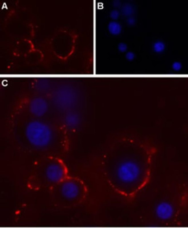 P2X4 (extracellular) Antibody in Immunocytochemistry (ICC/IF)