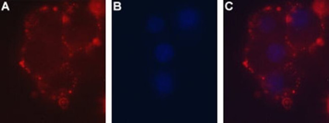 P2X2 (extracellular) Antibody in Immunocytochemistry (ICC/IF)