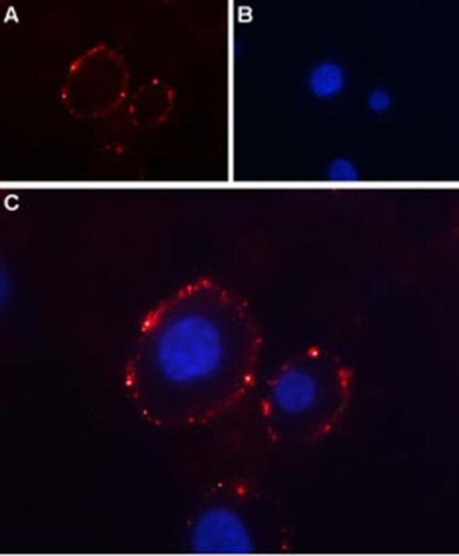 P2X3 (extracellular) Antibody in Immunocytochemistry (ICC/IF)