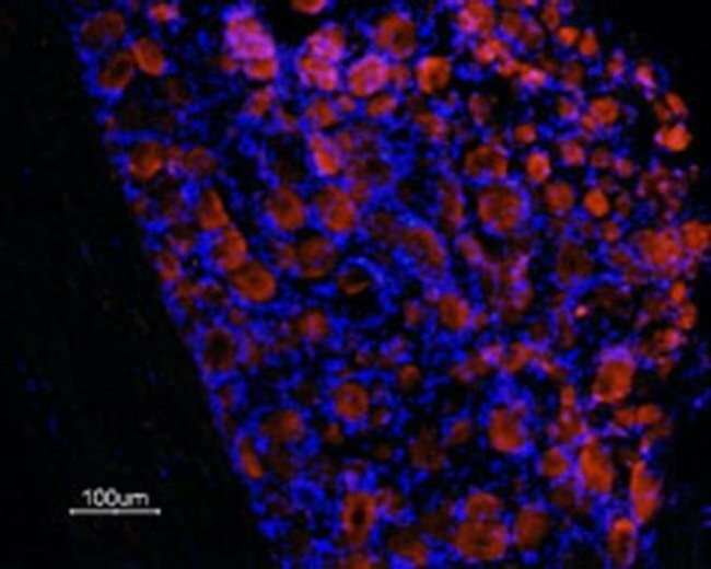 Prokineticin Receptor 1 (extracellular) Antibody in Immunohistochemistry (Frozen) (IHC (F))